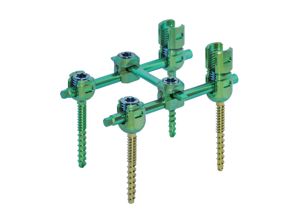脊柱内固定系统(VI)