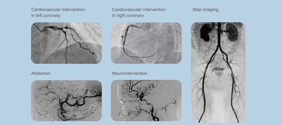 Vicor-CV Robin C / F数字减法血管造影系统